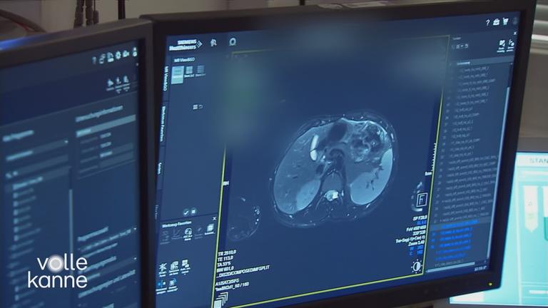 Röntgenaufnahme auf Bildschirm