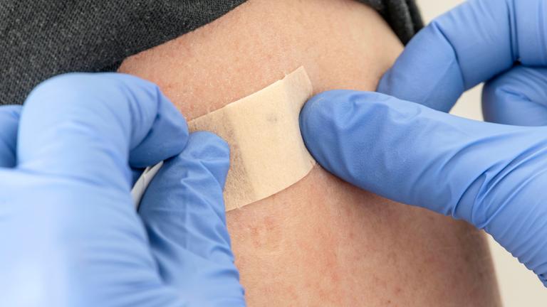 Symbolbild: Ein Impfpflaster nach einer Impfung auf dem Oberarm 
