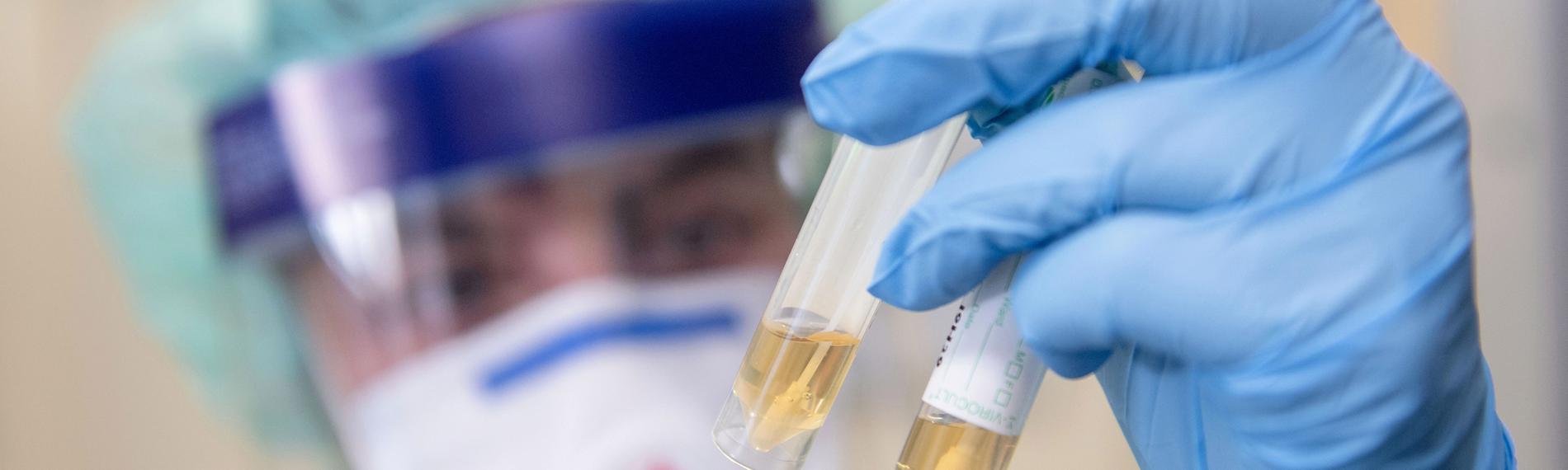 Eine Krankenschwester betrachtet zwei Abstrichröhrchen.