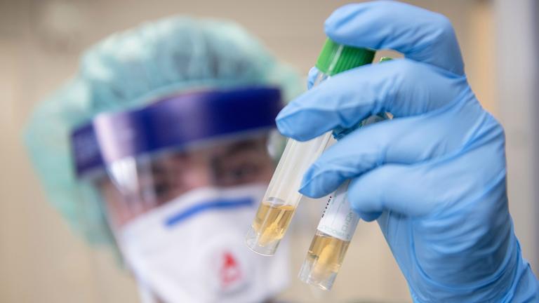 Eine Krankenschwester betrachtet zwei Abstrichröhrchen.