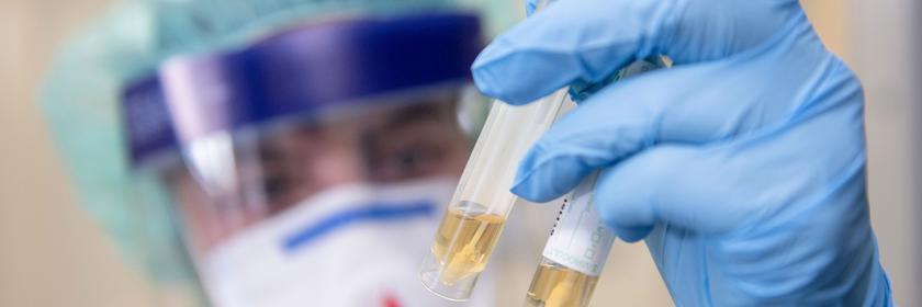 Eine Krankenschwester betrachtet zwei Abstrichröhrchen.