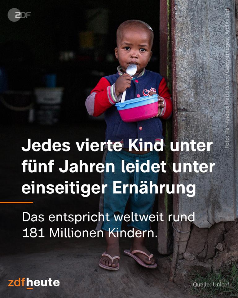 Infografik: Jedes vierte Kind unter fünf Jahren leidet unter einseitiger Ernährung