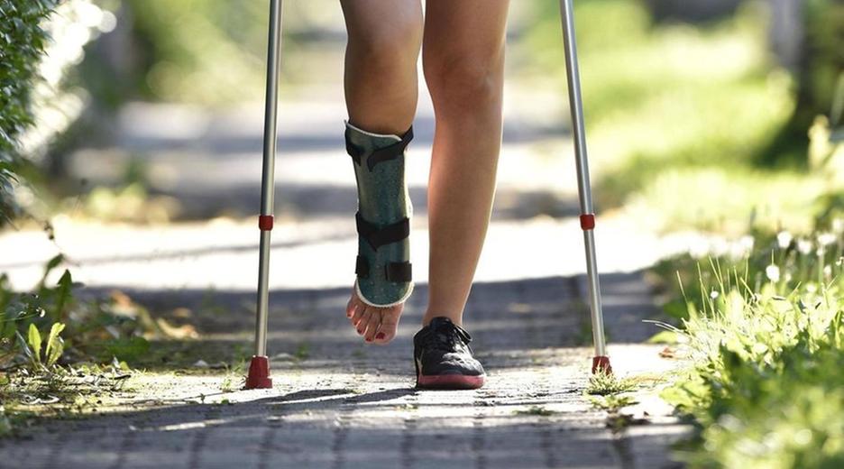 Junge Frau mit Gipsfuß
