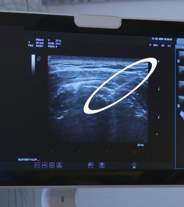 Needling bei Schulterschmerzen: Was es bringt