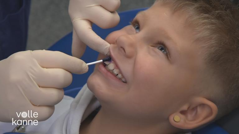 Wie man Karies erkennt, behandelt und verhindert