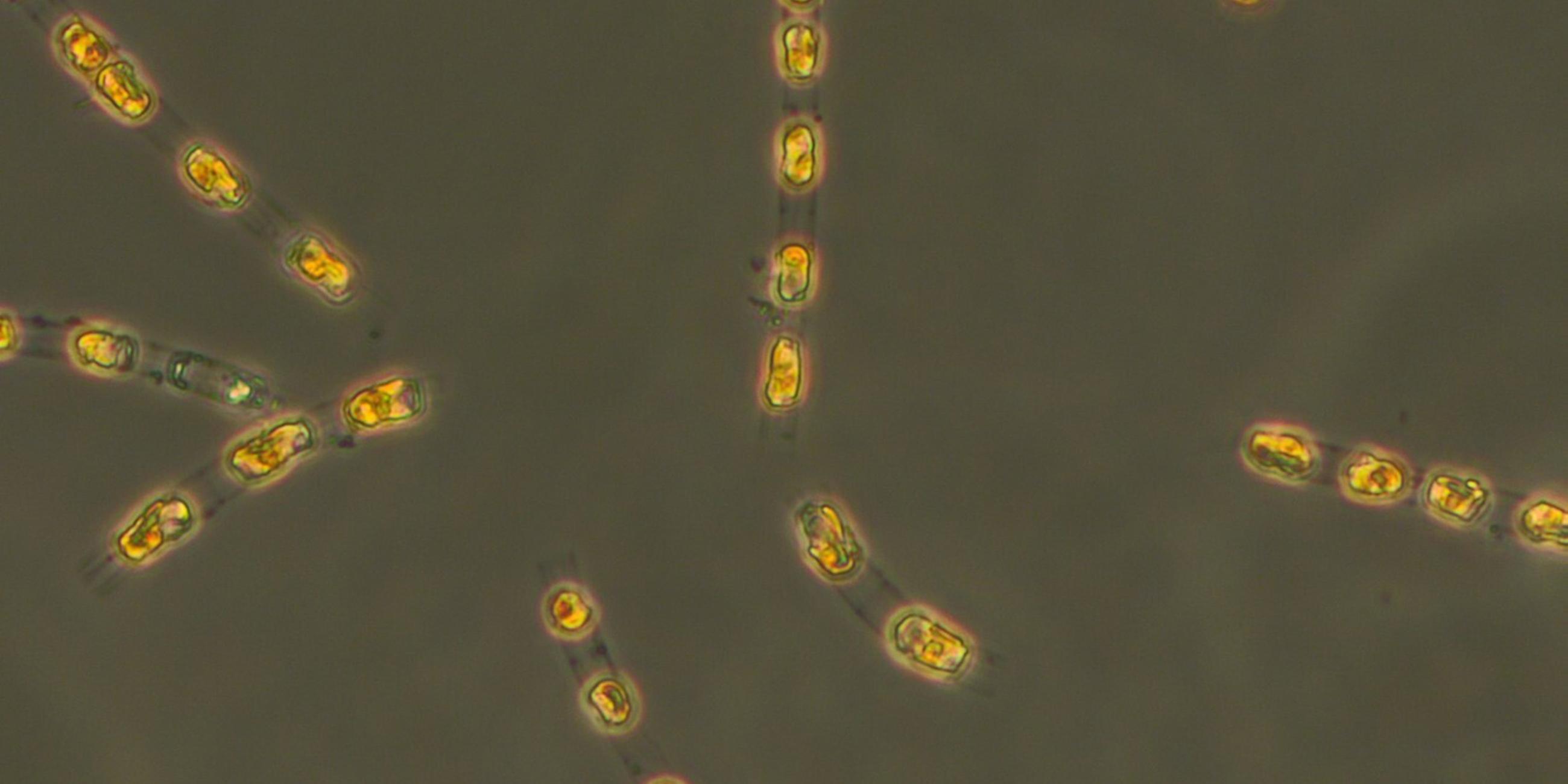 Kieselalge Skeletonema marinoi