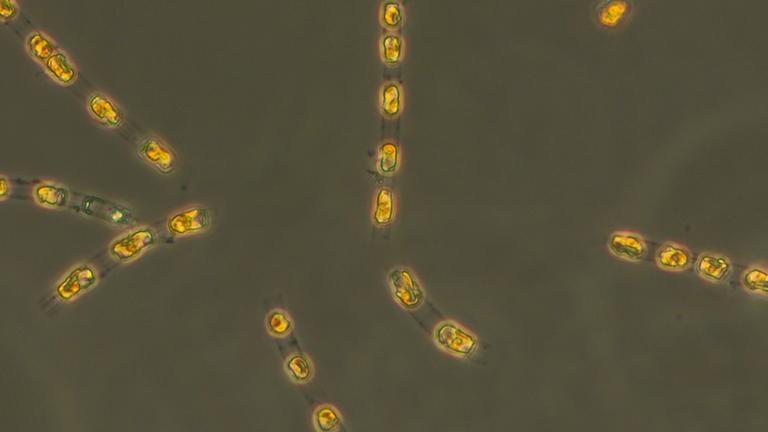 Kieselalge Skeletonema marinoi