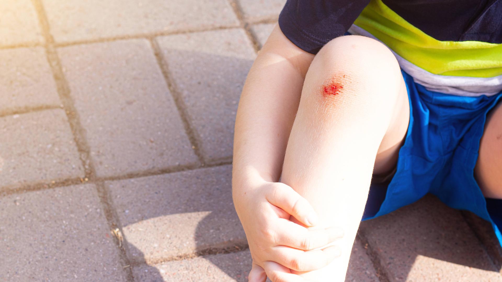 Kind mit Schürfwunde am Knie