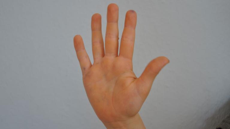 Kinderhand