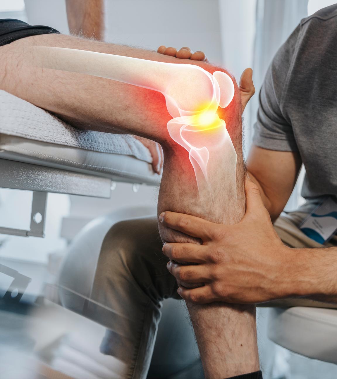 Das Knie eines Patienten wird untersucht. Auf diesem ist grafisch eine Arthrose eingefärbt.