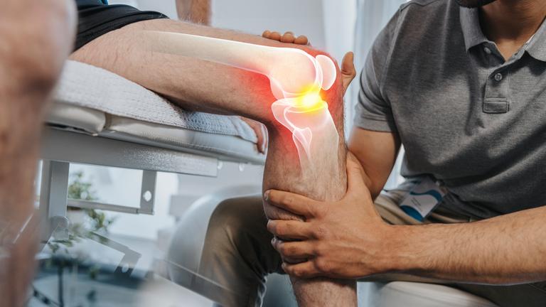 Das Knie eines Patienten wird untersucht. Auf diesem ist grafisch eine Arthrose eingefärbt.