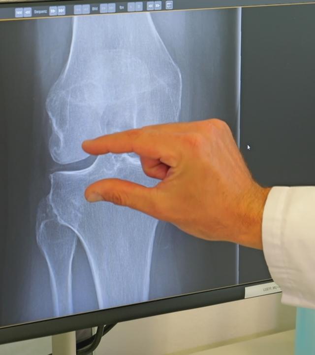 Röntgenbild vom Knie