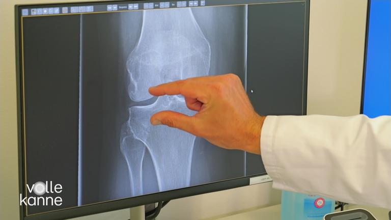 Röntgenbild vom Knie