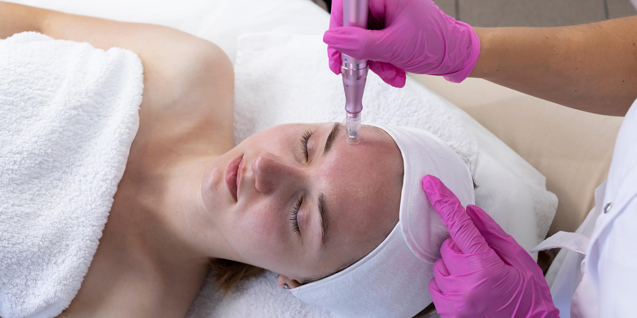 Kundin bei einer Gesichtsbehandlung mit dem Microneedling-Verfahren