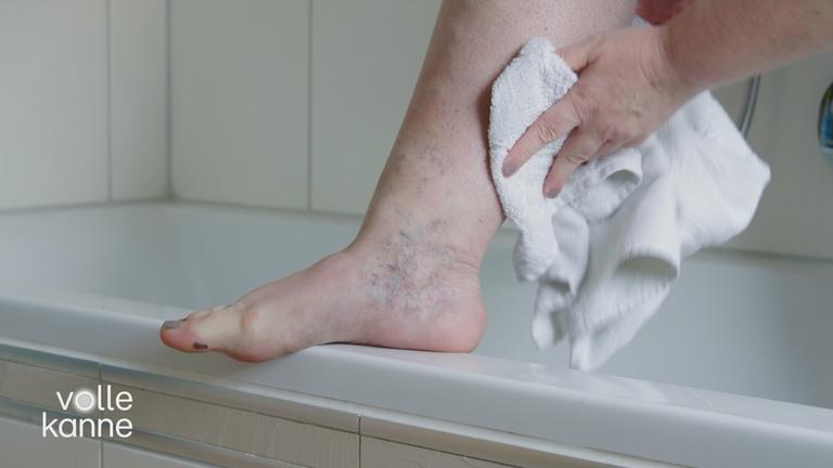 Krampfadern verhindern