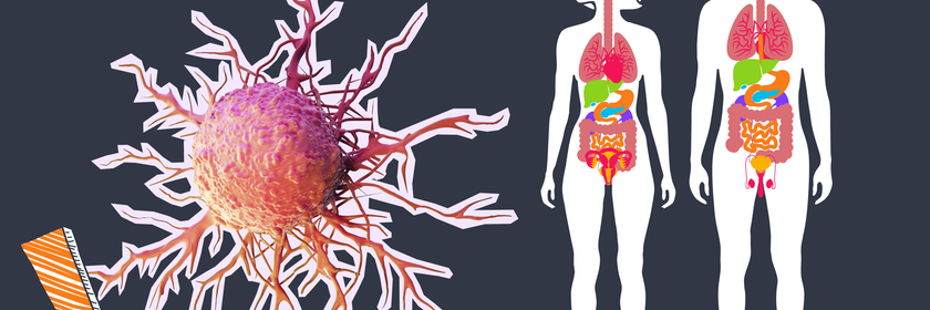 Grafik von eienr Krebszelle und zwei menschlichen Körpern und ein Ausrufezeichen