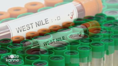 Das Bild zeigt eine Laborprobe vom West-Nil-Virus.