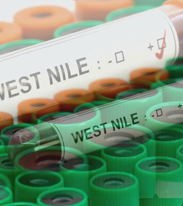 Das Bild zeigt eine Laborprobe vom West-Nil-Virus.