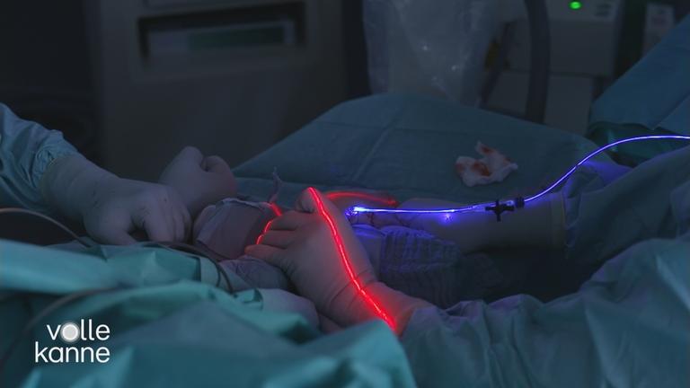 Arm bei einer Operation mit blauem Licht