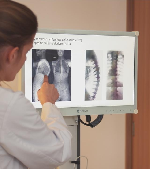 Ärztin zeigt Röntgenbilder von gekrümmten Wirbelsäule.