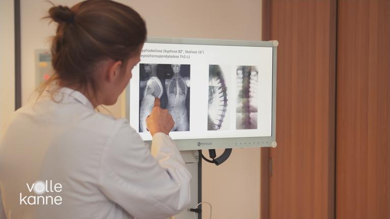 Ärztin zeigt Röntgenbilder von gekrümmten Wirbelsäule.