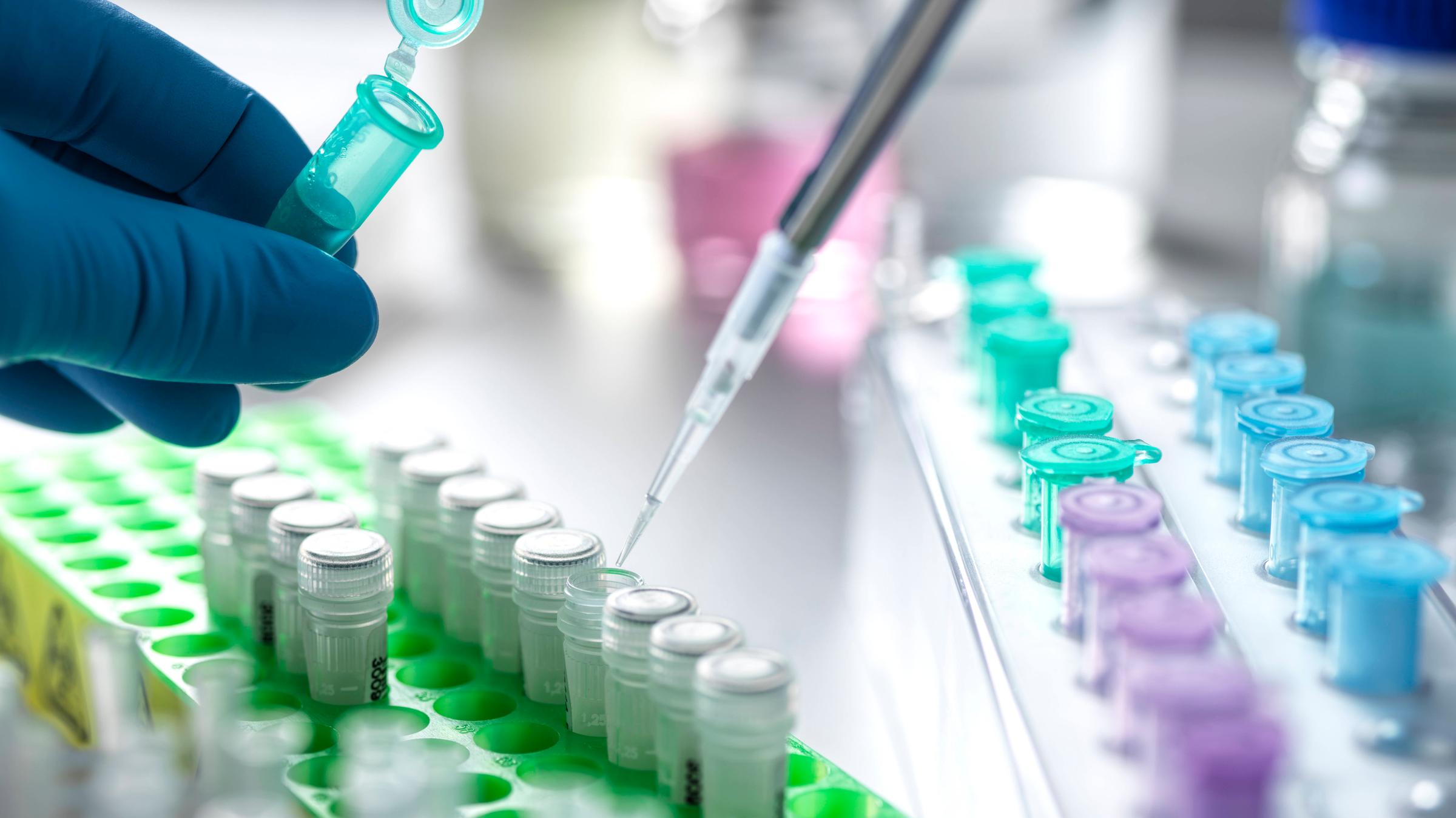In einem Labor wird für eine DNA-Analyse Probenmaterial mit einer Pipette in ein Röhrchen gefüllt.