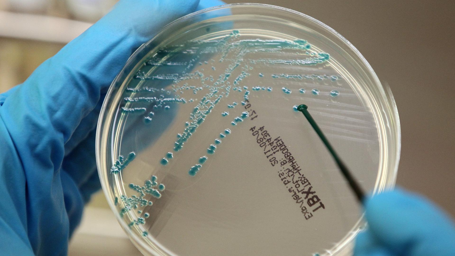 Archiv: Im Hauptlabor des Landesamtes für Landwirtschaft, Lebensmittelsicherheit und Fischerei Mecklenburg-Vorpommern (LALLF) in Rostock untersucht Patricia Becker am Montag (30.05.2011) an einer Sicherheitswerkbank Proben auf verotoxinbildende E. coli-Bakterien, zu denen der lebensbedrohlichen Darmkeim EHEC gehört.