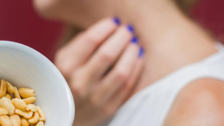 Eine Frau kratzt sich am Hals, im Vordergrund eine Schale mit Erdnüssen.