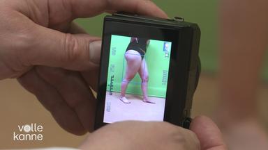 Die Kamera zeigt ein Foto von Beinen, die von Lipödem betroffen sind.