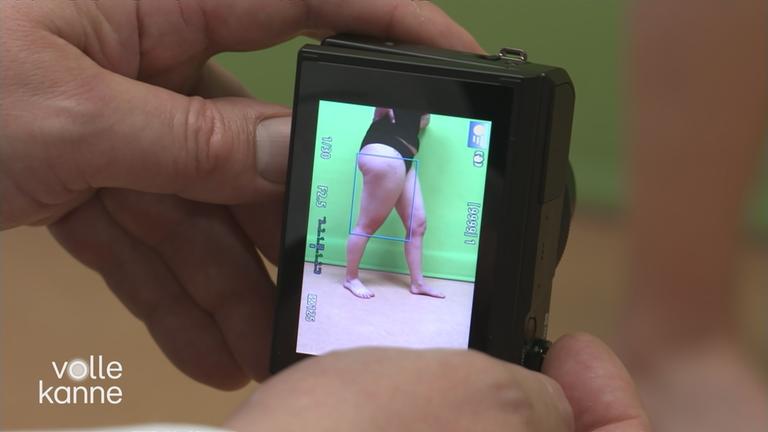 Die Kamera zeigt ein Foto von Beinen, die von Lipödem betroffen sind.