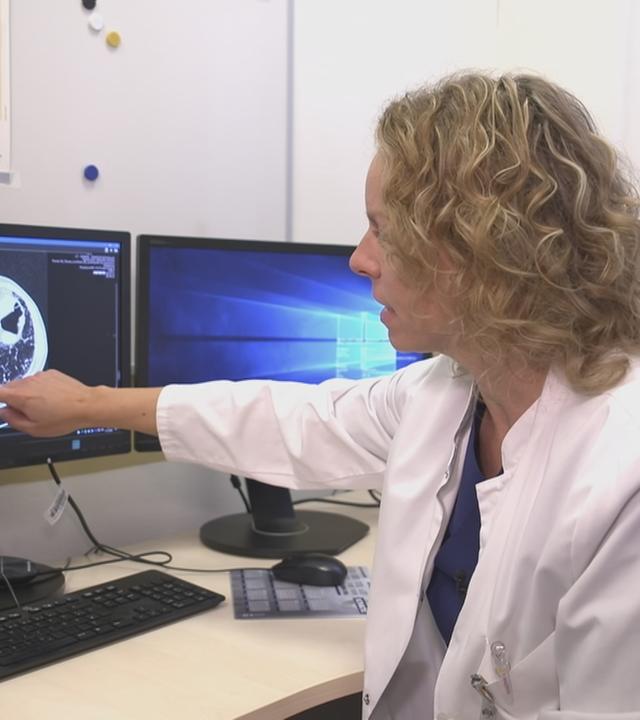 Ärztin zeigt auf ein Röntgenbild 