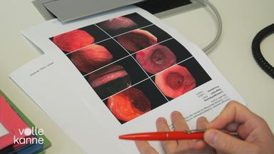 Ein Zettel liegt auf einem Schreibtisch, worauf Bilder einer Magenspiegelung zu sehen sind.