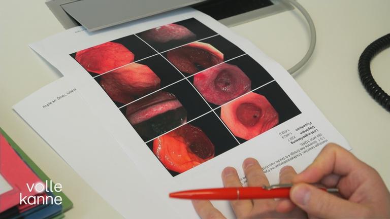 Ein Zettel liegt auf einem Schreibtisch, worauf Bilder einer Magenspiegelung zu sehen sind.