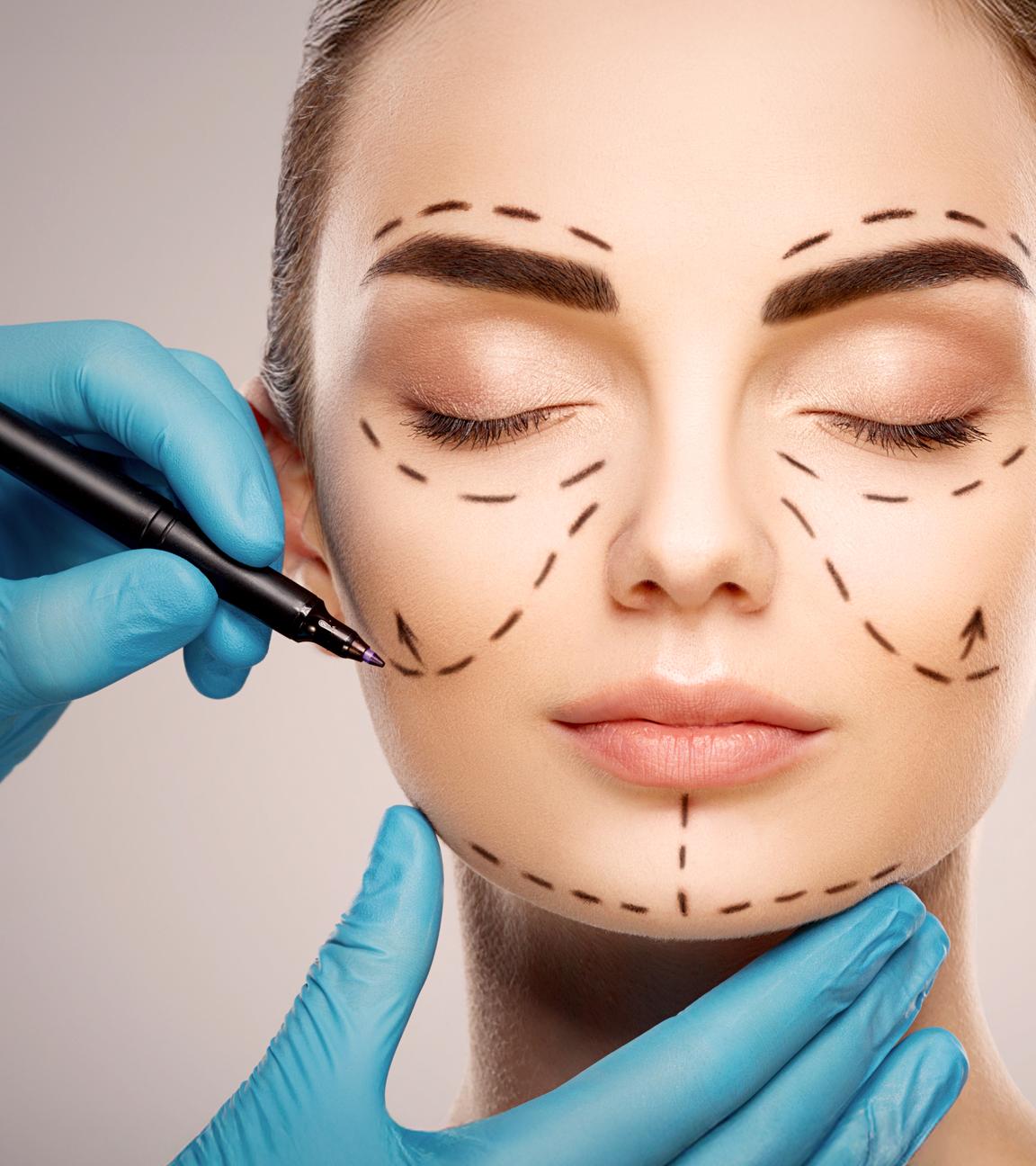 Das Gesicht einer Frau mit dunklen Augenbrauen vor hellem Studiohintergrund: Die Hände eines Arztes tragen blaue Handschuhe und zeichnen mit einem Stift Linien auf das Gesicht.