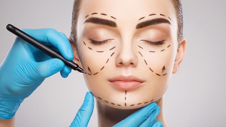Das Gesicht einer Frau mit dunklen Augenbrauen vor hellem Studiohintergrund: Die Hände eines Arztes tragen blaue Handschuhe und zeichnen mit einem Stift Linien auf das Gesicht.