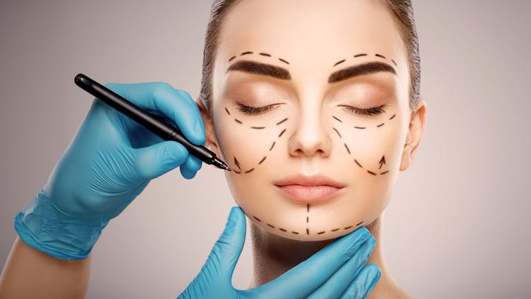 Das Gesicht einer Frau mit dunklen Augenbrauen vor hellem Studiohintergrund: Die Hände eines Arztes tragen blaue Handschuhe und zeichnen mit einem Stift Linien auf das Gesicht.