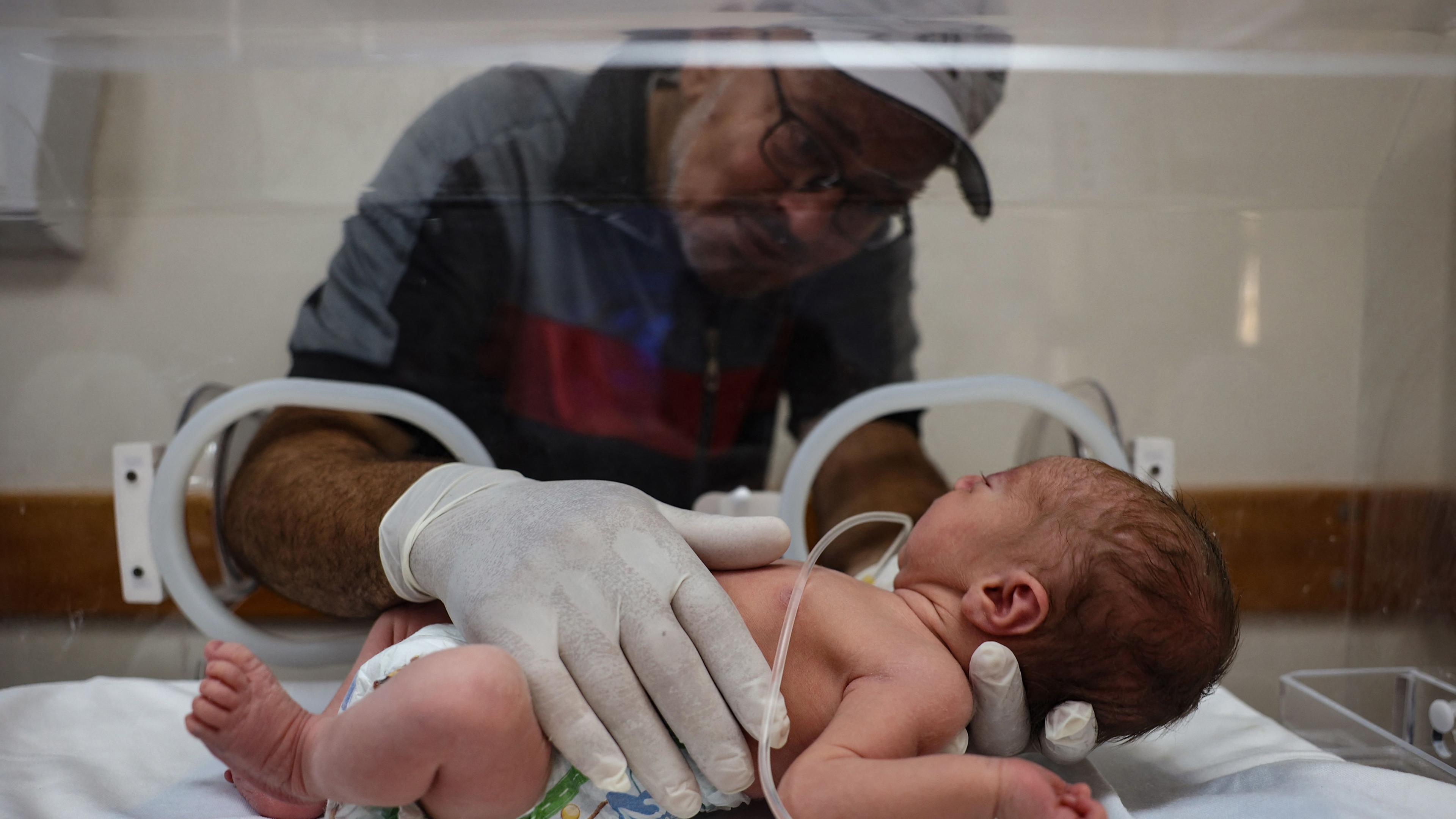 Das Baby Malek Yasine, das per Kaiserschnitt entbunden wurde, nachdem seine im neunten Monat schwangere Mutter ihren Verletzungen erlegen war am 20.07.2024.