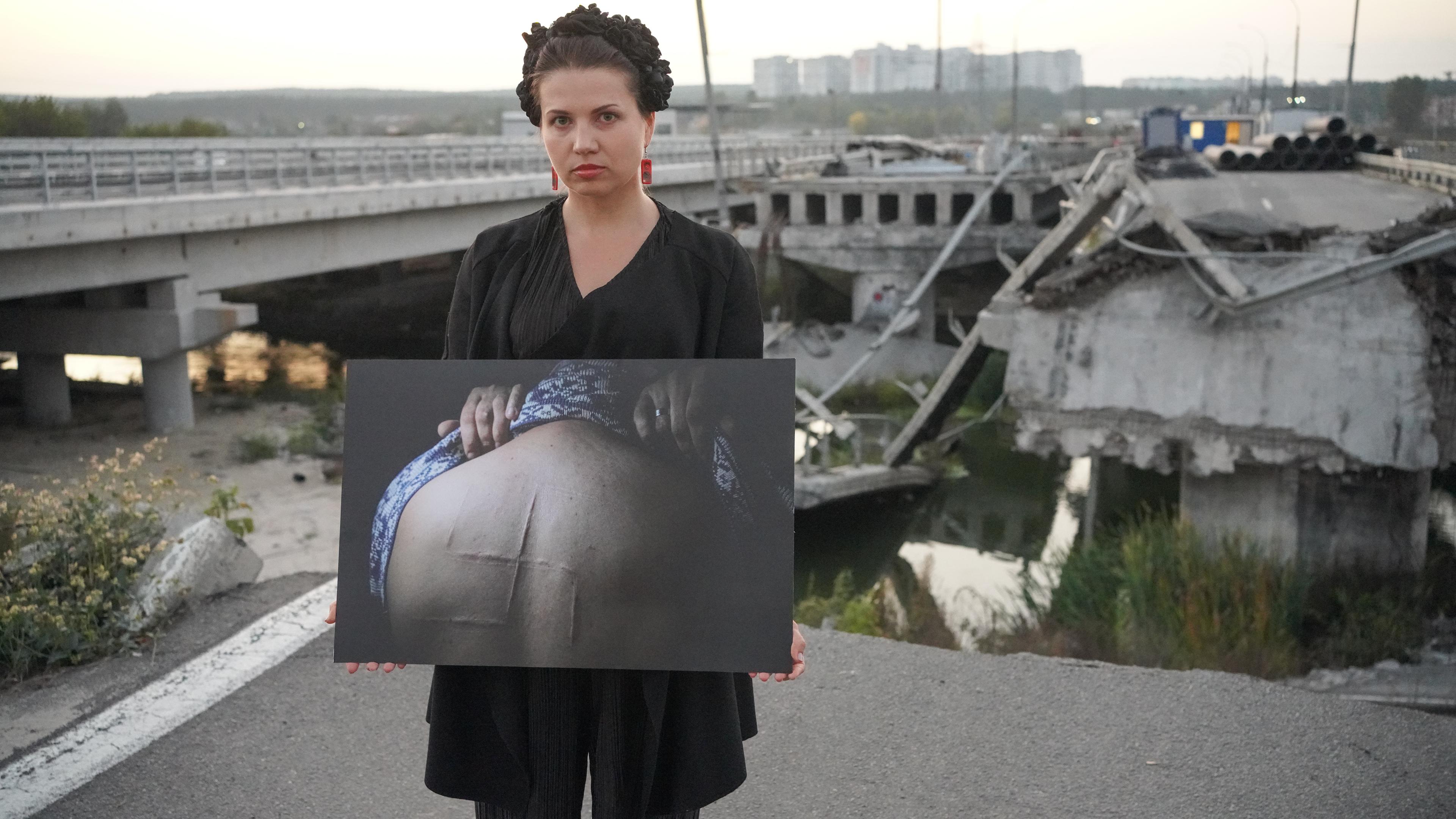 "Markus Lanz: Ukraine - Leben mit dem Krieg": Zoya Shu, eine ukrainische Fotografin, vor einer zerstörten Brücke, mit einem Bild in der Hand auf dem ein Rücken mit eingeritztem Hakenkreuz zu sehen ist.