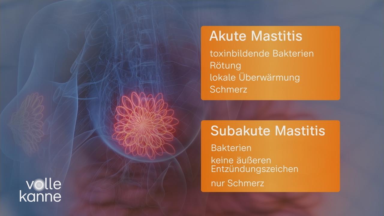 mastitis-entz-ndung-der-brustdr-se
