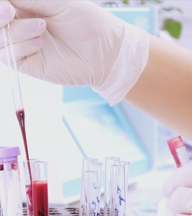 Bild im Labor: Mit einer Pipette wird eine rote Flüssigkeit in ein Reagenzglas gefüllt.