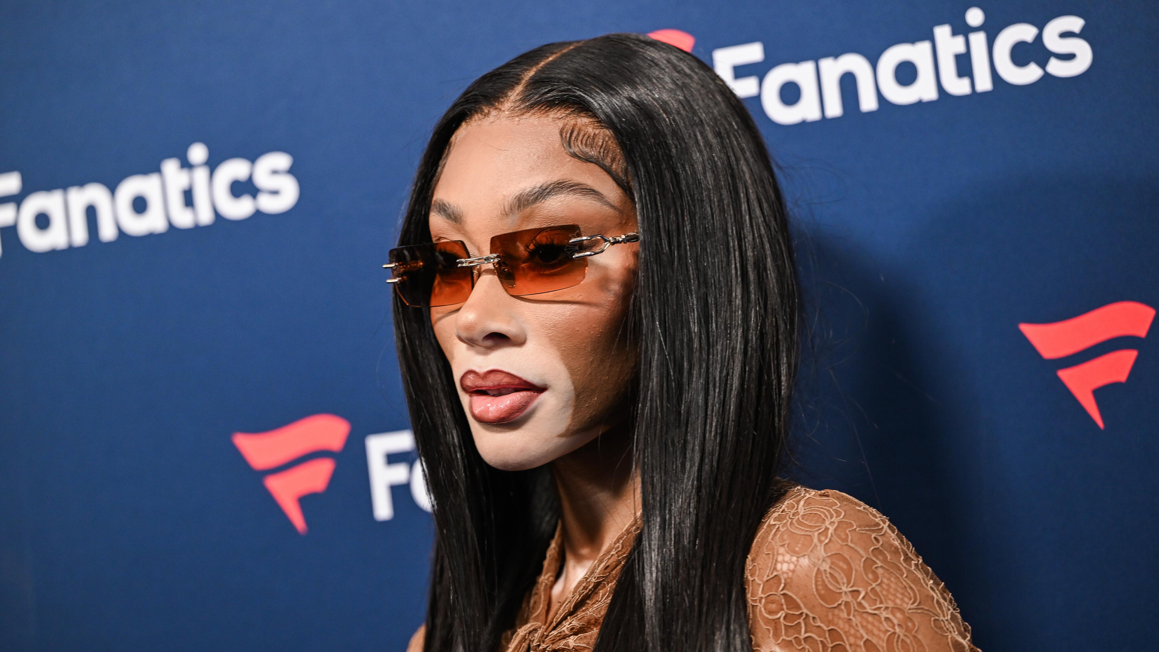 Model Winnie Harlow
