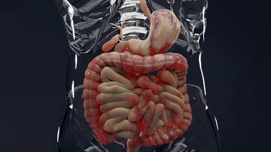 Männliche Anatomie mit Morbus Crohn.
