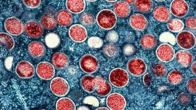 Dieses undatierte Bild des National Institute of Allergy and Infectious Diseases zeigt eine kolorierte Transmissionselektronenmikroskopaufnahme von Affenpockenpartikeln (rot), die in einer infizierten Zelle (blau) gefunden und im Labor kultiviert wurden
