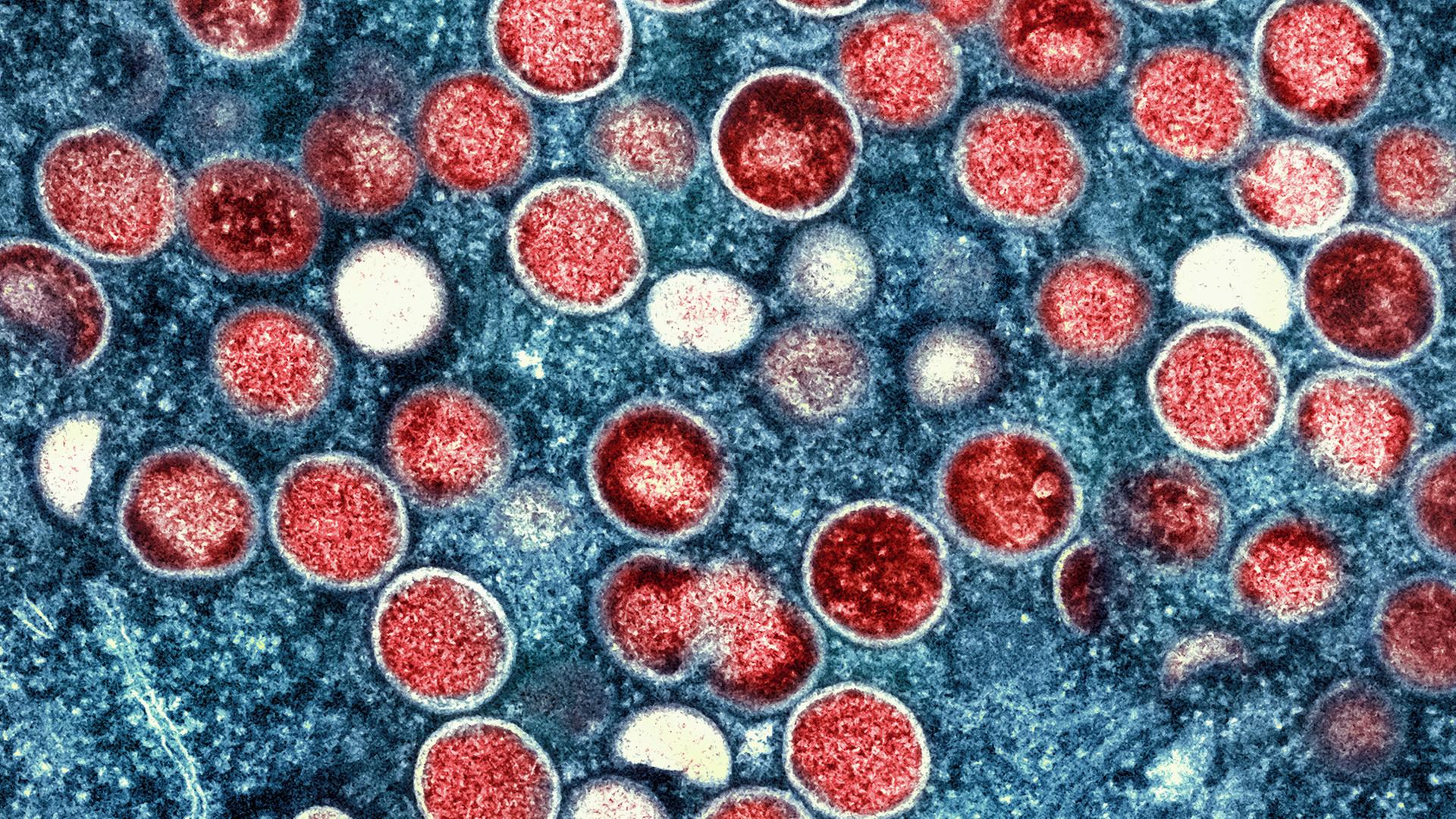 15.08.2024, USA, Fort Detrick: Dieses undatierte Bild, das vom National Institute of Allergy and Infectious Diseases zur Verfügung gestellt wurde, zeigt eine kolorierte Transmissionselektronenmikroaufnahme von Affenpockenpartikeln (rot) in einer infizierten Zelle (blau), die im Labor kultiviert und in der NIAID Integrated Research Facility in Fort Detrick aufgenommen und farblich verbessert wurde.
