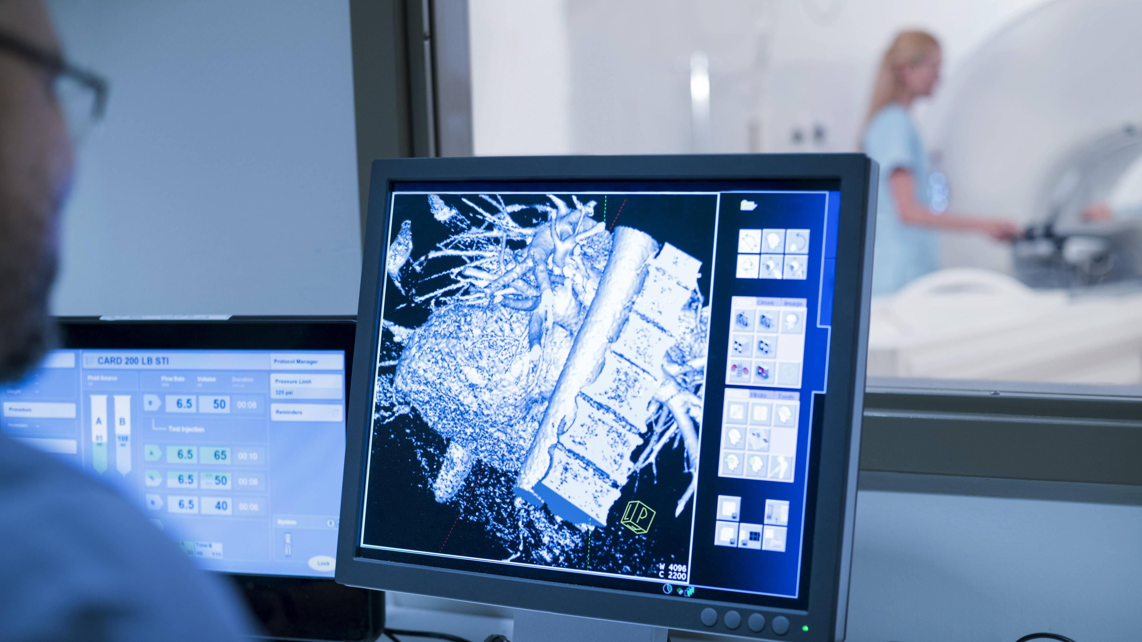Das Wirbelsäulen-MRT ist eine eine Möglichkeit, Morbus Bechterew zu diagnostizieren.