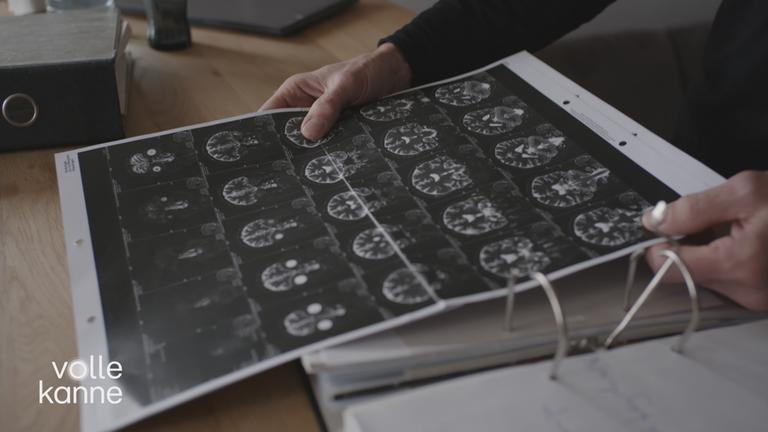 Multiple Chemikaliensensibilität