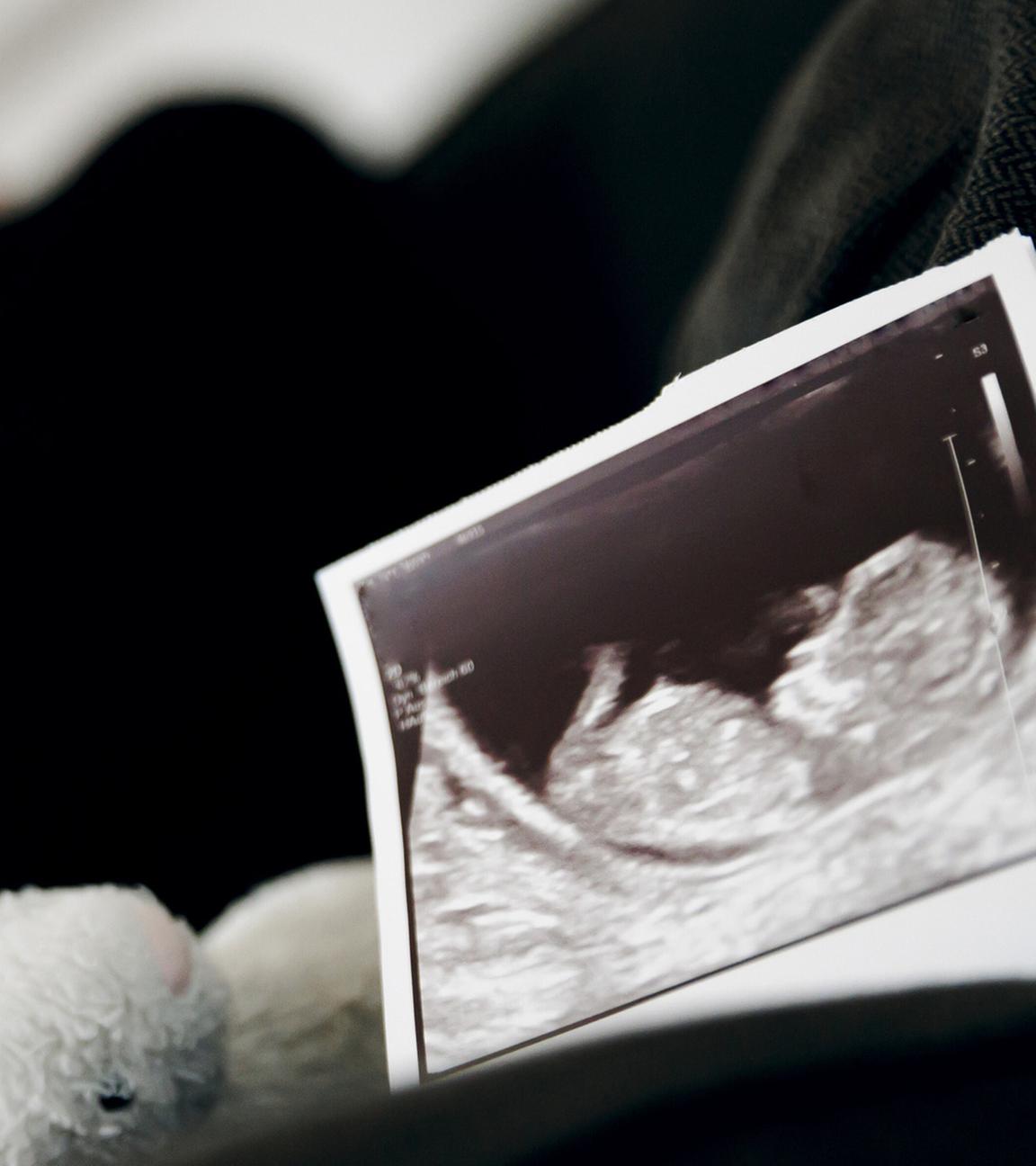 Symbolfoto: Gestellte Aufnahme zum Thema Fehlgeburt. Das Ultraschallbild eines ungeborenen Kindes steht neben einem Kuscheltier waehrend eine Frau im Hintergrund ihr Gesicht in ihren Händen verbirgt. Berlin, 22.08.2023.