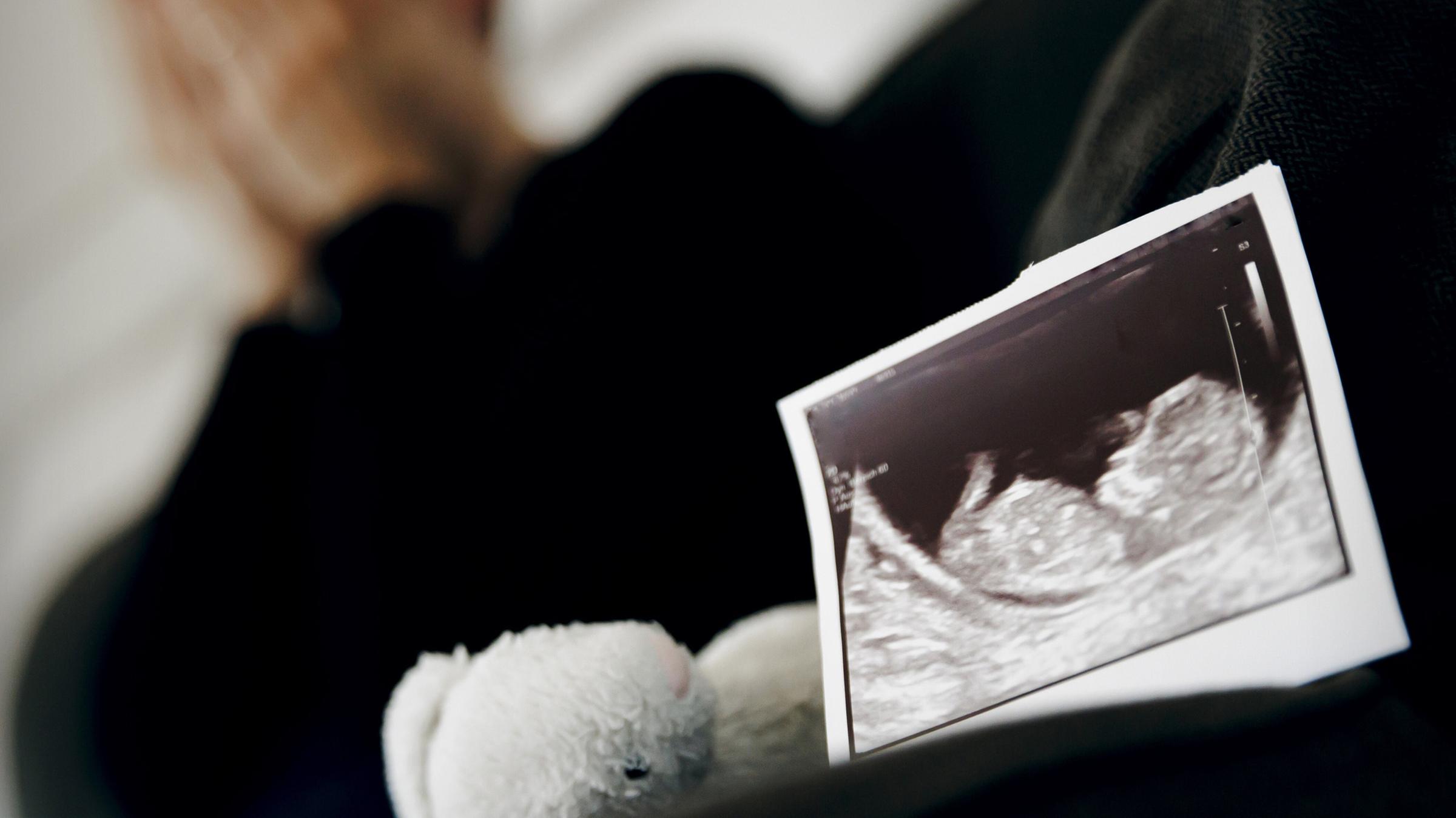Symbolfoto: Gestellte Aufnahme zum Thema Fehlgeburt. Das Ultraschallbild eines ungeborenen Kindes steht neben einem Kuscheltier waehrend eine Frau im Hintergrund ihr Gesicht in ihren Händen verbirgt. Berlin, 22.08.2023.