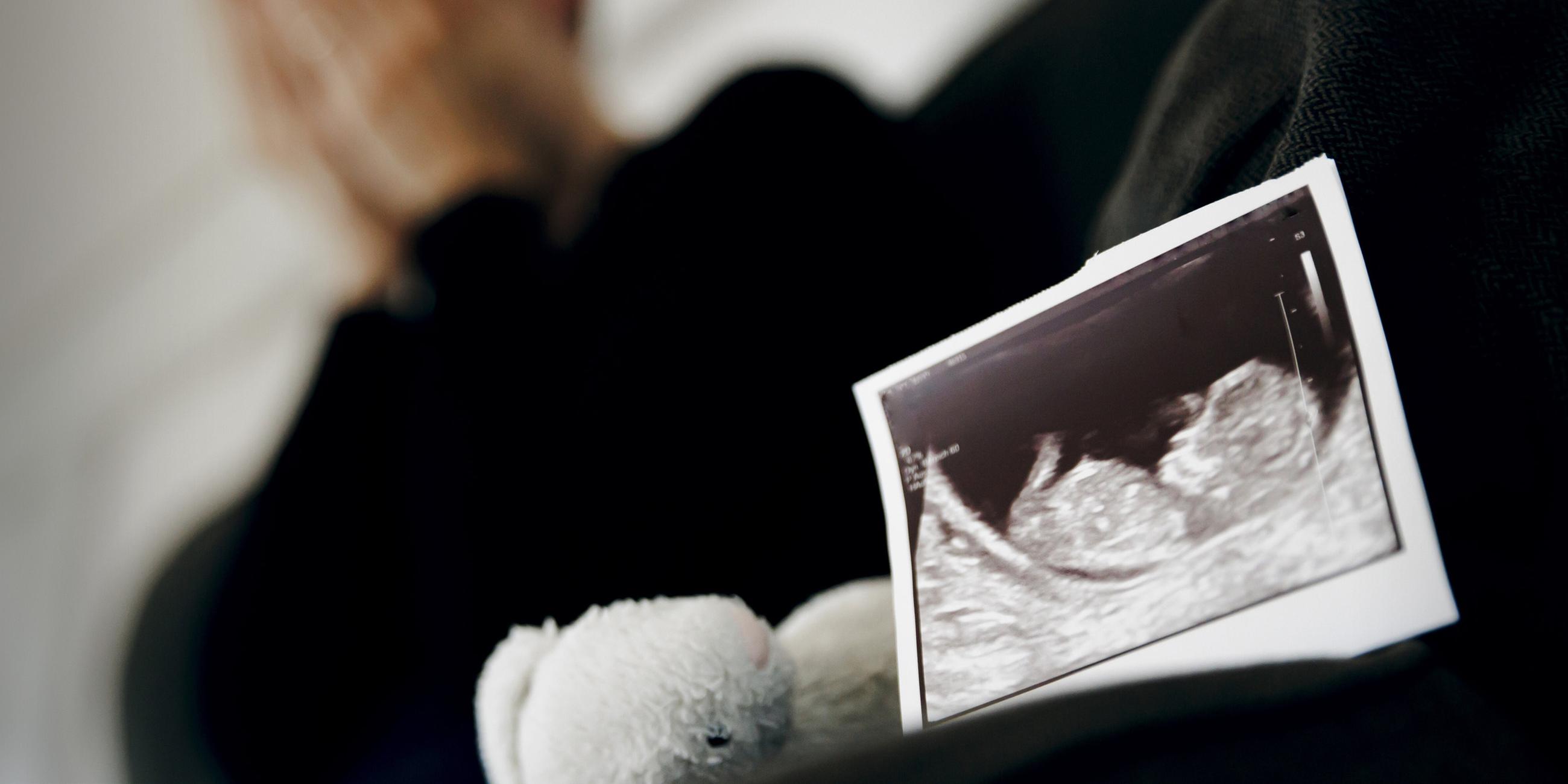 Symbolfoto: Gestellte Aufnahme zum Thema Fehlgeburt. Das Ultraschallbild eines ungeborenen Kindes steht neben einem Kuscheltier waehrend eine Frau im Hintergrund ihr Gesicht in ihren Händen verbirgt. Berlin, 22.08.2023.