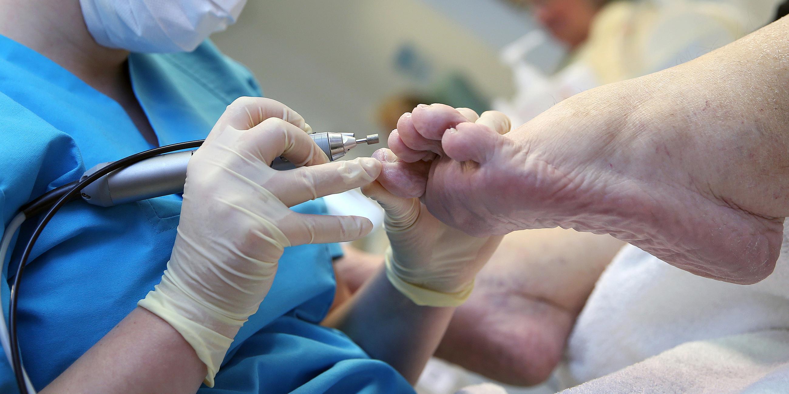 Eine medizinisch geschulte Person reinigt die Zehennägel einer Patientin.